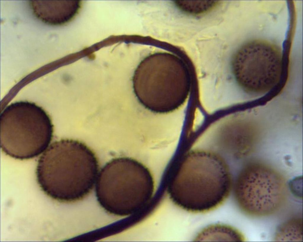 Sconosciuto myxo nivicolous da Olympos